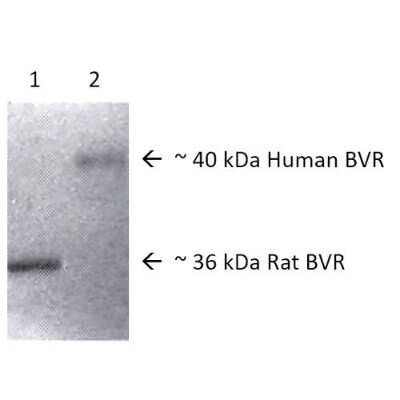 Western Blot: Biliverdin Reductase A/BLVRA Antibody [NBP3-18247]